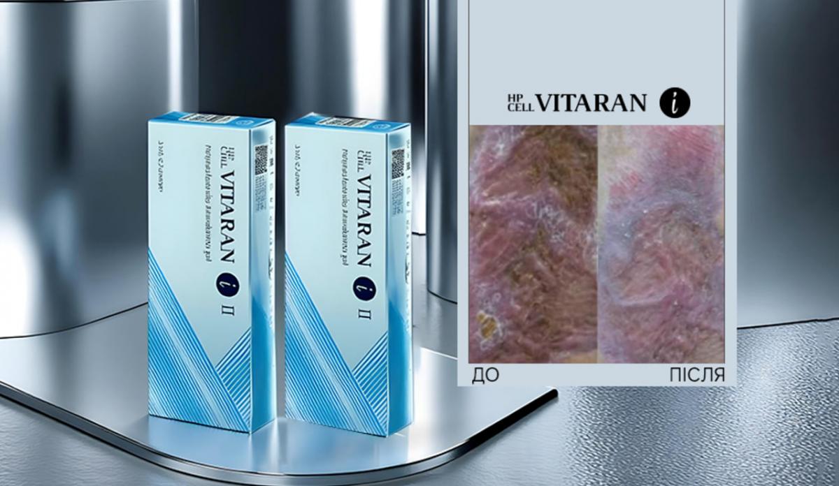 Jaroslavas Lata EMET interneto svetainėje pasidalijo patirtimi apie HP Cell Vitaran naudojimą gydant karių nudegimus