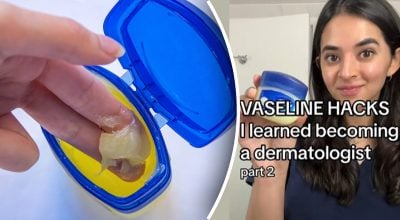 Kam tinka vazelinas: 12 panaudojimo būdų, kurie jus nustebins