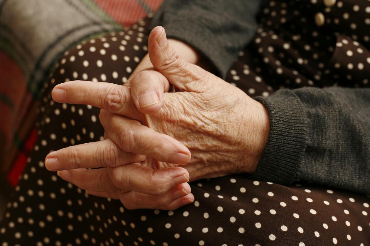 Kaip suminkštinti šiurkščią ir sausą rankų odą: 7 paprasti liaudiški
