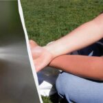 Ką daryti, jei nudegėte saulėje: gydytojas atskleidžia šešis veiksmingus patarimus
